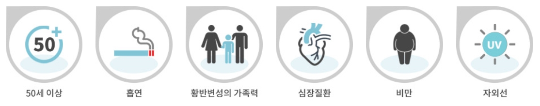 황반변성 원인